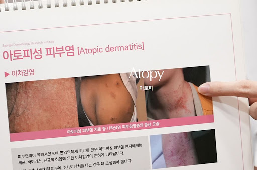 생기한의원이 정리한 아토피 피부 보습 관리 확인 사항